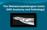 The Metatarsophalangeal Joints (MR Anatomy and … fellows/2008/Amanda Murphy MTP joints web.pdfThe Metatarsophalangeal Joints ... capsuloligamentous structures ... The Metatarsophalangeal