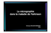 La micrographie 2 - Ponttpontt.net/wp-content/uploads/2010/02/Micrographieparkinsonienne.pdf · Survenue et fréquence •L’altération de l’écriture est un signe précoce •Peut