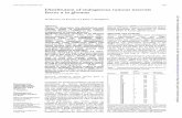 7 Distribution of endogenous necrosis factor a in gliomasjcp.bmj.com/content/jclinpath/50/7/559.full.pdf · OA, oligo-astrocytoma; AOA, anaplastic oligo-astrocytoma; NA,surroundingbraintissue