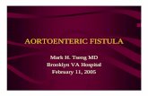 M&M Aortic enteric fistula - Department of Surgery at SUNY Downstate Medical · PDF file · 2009-01-25AORTOENTERIC FISTULA • Carries a very high morbidity and mortality • 100%
