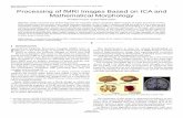 Processing of fMRI Images Based on ICA and … of fMRI Images Based on ICA and Mathematical Morphology Ali Akbar Pouyan, Seyed Mahdi Salehi Abstract—Health monitoring and medical