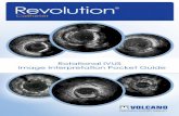 Rotational IVUS Image Interpretation Pocket Guide · Nearby side branches can act as landmarks. ... Europe Headquarters Excelsiorlaan 41 B-1930 Zaventem Belgium Phone: +32-2-679-1076