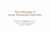 The Pathology of Acute Myocardial Infarction - Inicio · Scope of Presentation •Incidence, classification and treatment of acute myocardial infarction •The classical pathology