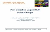 Post Operative Vaginal Cuff Brachytherapy - GCIG Small SPEAKER Vaginal... · Post Operative Vaginal Cuff Brachytherapy William Small, Jr., M.D., FACRO, FACR, FASTRO ... TAH-BSO R