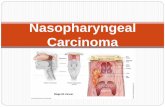 Nasopharyngeal Carcinoma - ENT Lectures Presentations/PowerPoint... · nasopharyngeal carcinoma in the right nasopharynx (arrow) invading posterolaterally. MRI . Chest radiography