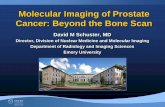 Molecular Imaging of Prostate Cancer: Beyond the Bone Scan · Molecular Imaging of Prostate Cancer: Beyond the Bone Scan David M Schuster, MD Director, Division of Nuclear Medicine