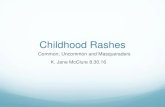 Childhood Rashes - Guide to YKHC Medical Practices Rashes Common, Uncommon and Masqueraders K. Jane McClure 8.30.16 Objectives Recognize common, not so concerning viral rashes Think
