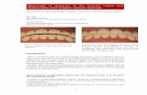 Anterior Clearance Report - jpda.dentaljpda.dental/pdf/ACR.pdfIn order to understand complete denture occlusion, understanding of dentulous occlusion would be an easier way, and so