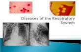 Diseases of the Respiratory System - Austin Community …€¦ · PPT file · Web view · 2010-11-12Diseases of the Respiratory System ... Diseases of the Respiratory System Respiratory