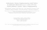 Automatic Aorta Segmentation and Valve Landmark Detection in C-Arm CT ... · Automatic Aorta Segmentation and Valve Landmark Detection in C-Arm CT for Transcatheter Aortic Valve Implantation