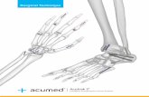 Acutrak 2 - Acumed | Innovation With Purpose Fusion Technique 11 Jones Fracture Technique 13 Calcaneal Osteotomy Technique 17 Ordering Information 21 Notes 25 Acumed® is a global