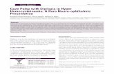 Gaze Palsy with Diplopia in Hyper Homocysteinemia: A · PDF fileGaze Palsy with Diplopia in Hyper Homocysteinemia: A Rare Neuro-ophthalmic Presentation ... onset and the absence of