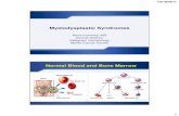 Myelodysplastic Syndromes - Aplastic Anemia and MDS ...assets.aamds.org/pdfs/Komrokji.pdf · Myelodysplastic Syndromes Rami Komrokji, MD ... 5 What Causes MDS? ... examine the peripheral