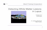 Detecting White Matter Lesions in Lupus - NA-MIC . Jeremy Bockholt and Mark Scully National Alliance for Medical Image Computing-1- Detecting White Matter Lesions in Lupus H. Jeremy