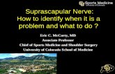Suprascapular Nerve: How to identify when it is a … Nerve: How to identify when it is a ... rotator cuff tear and muscle atrophy. Vadet al, ... PowerPoint Presentation