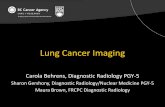 Lung Cancer Imaging Cancer Imaging Carola Behrens, Diagnostic Radiology PGY-5 Sharon Gershony, Diagnostic Radiology/Nuclear Medicine PGY-5 Maura Brown, FRCPC Diagnostic ... Objectives