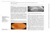 Fundus albipunctatus associatedwith dystrophybjo.bmj.com/content/bjophthalmol/76/6/375.full.pdf · YozoMiyake,NoriyasuShiroyama, ShintaroSugita,MasayukiHoriguchi,KatsuyaYagasaki Abstract