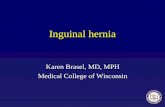 [PPT]Slide 1 education/ASE Support... · Web viewSummary Inguinal hernia is primarily a clinical diagnosis Ultrasound can be helpful in diagnosing testicular torsion; also if hernia