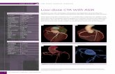 Low-dose CTA With ASiR - Home - GE Healthcare/me… ·  · 2012-06-04Optima CT660 with ASiR Scan type/slice thickness: Snapshot Pulse / ... Low-dose CTA With ASiR By Roberto Cury,