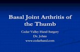 Basal Joint Arthritis of the Thumb - American …orthodoc.aaos.org/cedarvalleyhand/BasalJointPPT.pdfBasal Joint Arthritis of the Thumb Cedar Valley Hand Surgery Dr. Johns Anatomy The