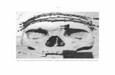 fig. 1) Crown molded onto the forehead. Larger number of ... · 4 fig. 1) Crown molded onto the forehead. Larger number of thorns in contact with the bone.