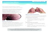 Patient Fact Sheet Eczema Fact Sheet - Aspen · PDF filePatient Fact Sheet Eczema Fact Sheet What is Eczema? Your Doctor has prescribed a topical ... The goal of treating eczema is