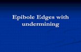 Epibole Edges with undermining - Altru - Altru Health ... Edges.pdf · Answer C and D- Silver nitrate or sharp debridement Epibole edges: Edges of top layers of epidermis have rolled