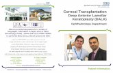 Corneal Transplantation DALK May 2016 · Page 12 Patient Information Corneal Transplantation Deep Anterior L amellar Keratoplasty (DALK) Ophthalmology Department