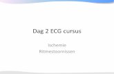 ECGpedia ECG cursus · PDF fileECG cursus DOKH dagdeel 2 dr. R.B.A. van den Brink, Cardioloog/opleider AMC non-profit / open access / physician moderated / up-to-date