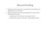 Wound healing - gmch.gov.in lectures/Pathology/L10 wound  · PDF fileWound healing • Healing of skin wounds- example of combination of regeneration and repair. • Wound healing