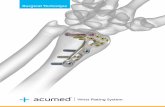 Acumed® Wrist Plating System - OrthoAktiv … 2_Acumed... · 3 Acumed® Acu-Loc® 2 rist Plating System Surgical Technique The standard Acu-Loc 2 Plate is designed to closely replicate