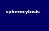 spherocytosis - gsia.tums.ac. abnormal osmotic fragility in vitro ... on osmotic fragility test