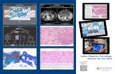Johns Hopkins Pathology - SBP · The Johns Hopkins Pathology Atlases are iPad apps designed to teach residents, fellows, and practicing pathologists ... Johns Hopkins Atlas of Thyroid