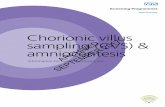 Chorionic villus sampling (CVS) & 2017 ARCHIVED ... · 2. NHS Fetal Anomaly Screening Programme . Chorionic villus sampling (CVS) and amniocentesis – Information for health professionals.