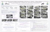 MR Imaging of the Fetal Cerebellar Vermis in Utero ... MRI/normal vermis.pdf · (image adapted from Duvernoy 1995) fastigium-declive line. lingula central lobule culmen declive folium
