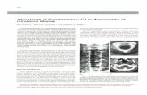 Advantages of Supplementary CT in Myelography of ... · Advantages of Supplementary CT in Myelography of Intraspinal Masses ... and localization of intraspinal mass ... along the