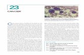 8751d c01 001-028 - UFRGS 23 Cancer.pdf · harmful tumors of glial cells). Some malignant tumors, such as those in the ovary or breast, remain localized and encap-sulated, at least