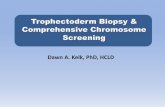 Trophectoderm Biopsy & Comprehensive … - CCS.pdf · Trophectoderm Biopsy Laser zona breach on Day 3 •Allows embryo to herniate out of zona on Day 5/6 ... don’t test junk Be