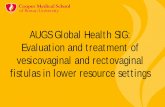AUGS Global Health SIG: Evaluation and treatment of … · Evaluation and treatment of vesicovaginal and rectovaginal fistulas in lower resource settings. Learning Objectives •
