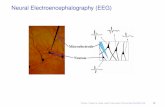 Neural Electroencephalography (EEG) - Oxford teh/teaching/smldmHT2014/   Hierarchical Clustering