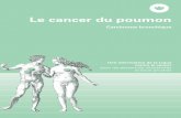 le Cancer Du Poumon – Un Guide - Assets.krebsliga.chassets.krebsliga.ch/downloads/2067.pdf · les pulmonaires. Les cellules can-céreuses peuvent migrer dans les ganglions lymphatiques