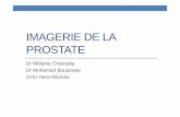 IMAGERIE DE LA PROSTATE - sfrnet.org · Généralités Anatomie zonale de Mc Neal • Evolution de la structure de la prostate avec l’âge • Zone périphérique • Prédominante
