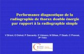Performance diagnostique de la radiographie de thorax ...pe.sfrnet.org/Data/ModuleConsultationPoster/pdf/2006/1/e3b6baa3-6b... · radiographie de thorax double énergie par rapport