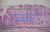 Colites Inflammatoires vs Colites Infectieuses ... · Diarrhée Chronique, Endoscopie normale. COLITE COLLAGÈNE. Diarrhée Chronique, Endoscopie normale. COLITE LYMPHOCYTAIRE. Colite