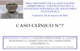CASO CLÍNICO Nº7 - sovapat.orgsovapat.org/hcuv/caso07/caso07.pdf · Infiltración por linfoma/leucemia de células pequeñas compatible con Tricoleucemia. Esplenitis granulomatosa