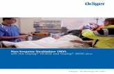 Non-Invasive Ventilation (NIV) with the Oxylog® … · Non-Invasive Ventilation (NIV) with the Oxylog® VE300 and Oxylog® 3000 plus D-370-2010D-13428-2017. 02 ... Turning NIV back