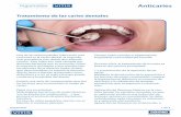 Anticaries - higienistasvitis.com · Bioquímica de la caries dental. ... del tratamiento de la caries dental, la cola-Tratamiento de las caries dentales boración del paciente una