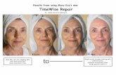 Results from using Mary Kay’s new TimeWise Repair · Results from using Mary Kay’s new TimeWise Repair Sr. Sales Director Bonny R. Dull, flat, very dry sagging skin with dark