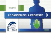 LE CANCER DE L A PROSTATE - Plan National Cancer · 3 ME N U LE CANCER DE L A PROSTATE 1. Introduction g n rale pg 4 2. G n ralit pg 5 a. La prostate 3. A d nome et cancer de la prostate,
