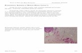PLEOMORPHIC ADENOMA (“BENIGN MIXED TUMOR”) · In the case of carcinoma ex pleomorphic adenoma, there should be some remaining pleo-morphic adenoma present to substantiate the